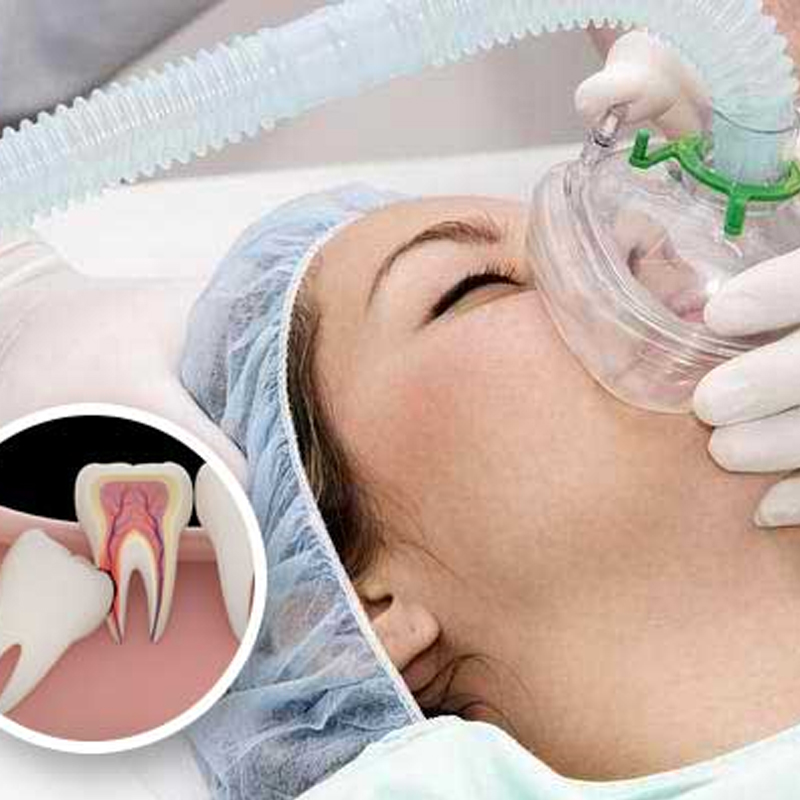 Wisdom Teeth Removal Enmore